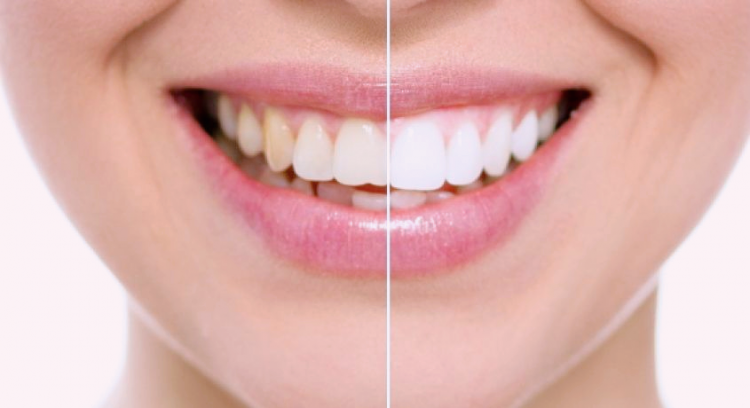 cosmetic dentistry in Ukraine