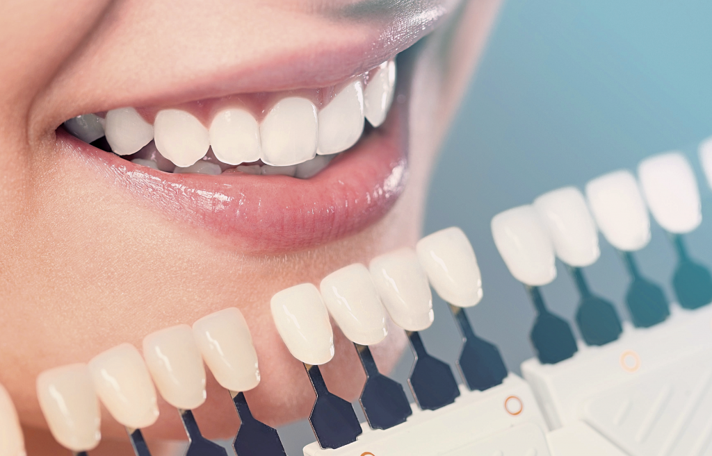 types of cosmetic dentistry